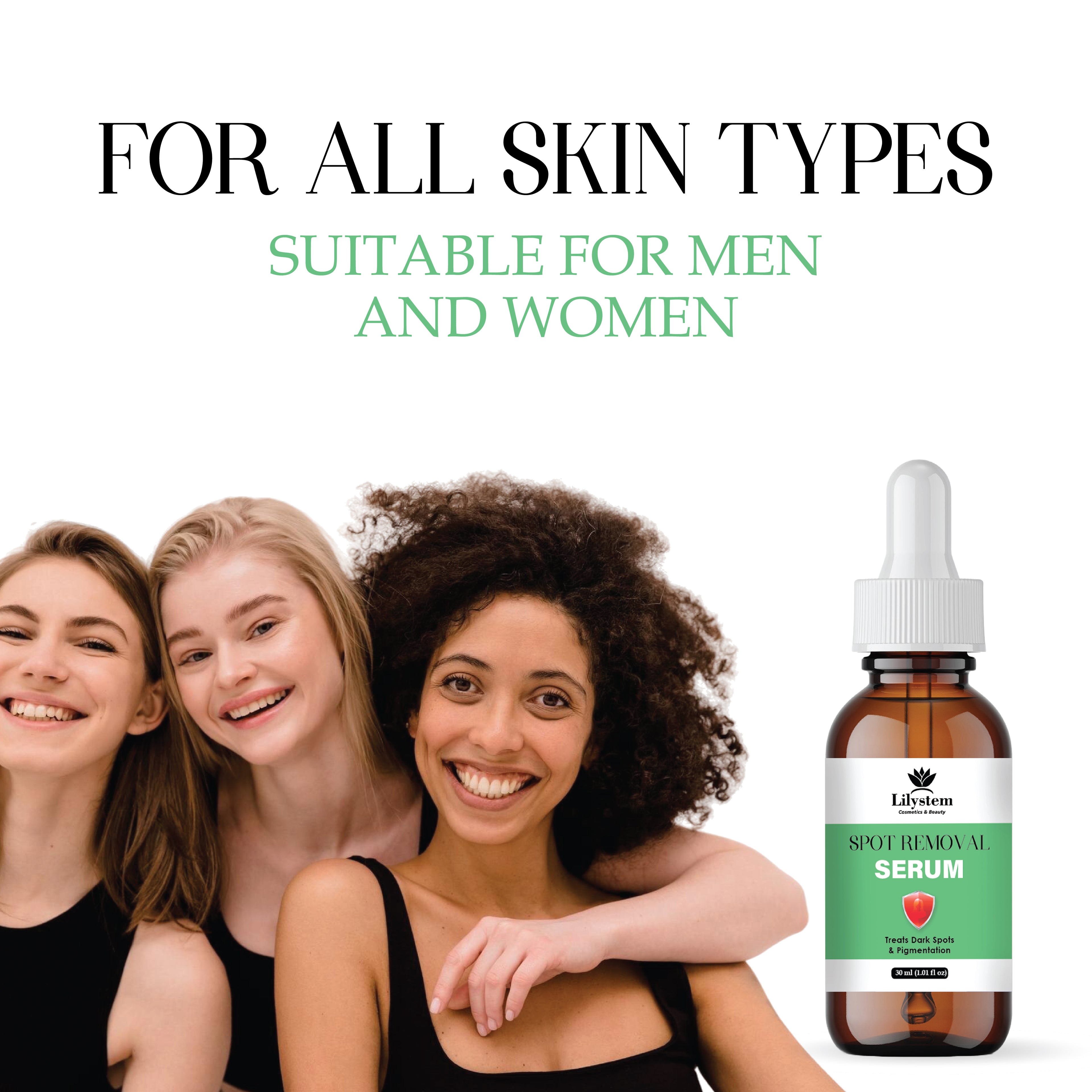 Dark Spot Remover for Face – Hyperpigmentation Serum with Niacinamide & Vitamin C – Acne Scar, Sun Spot & Melasma Treatment