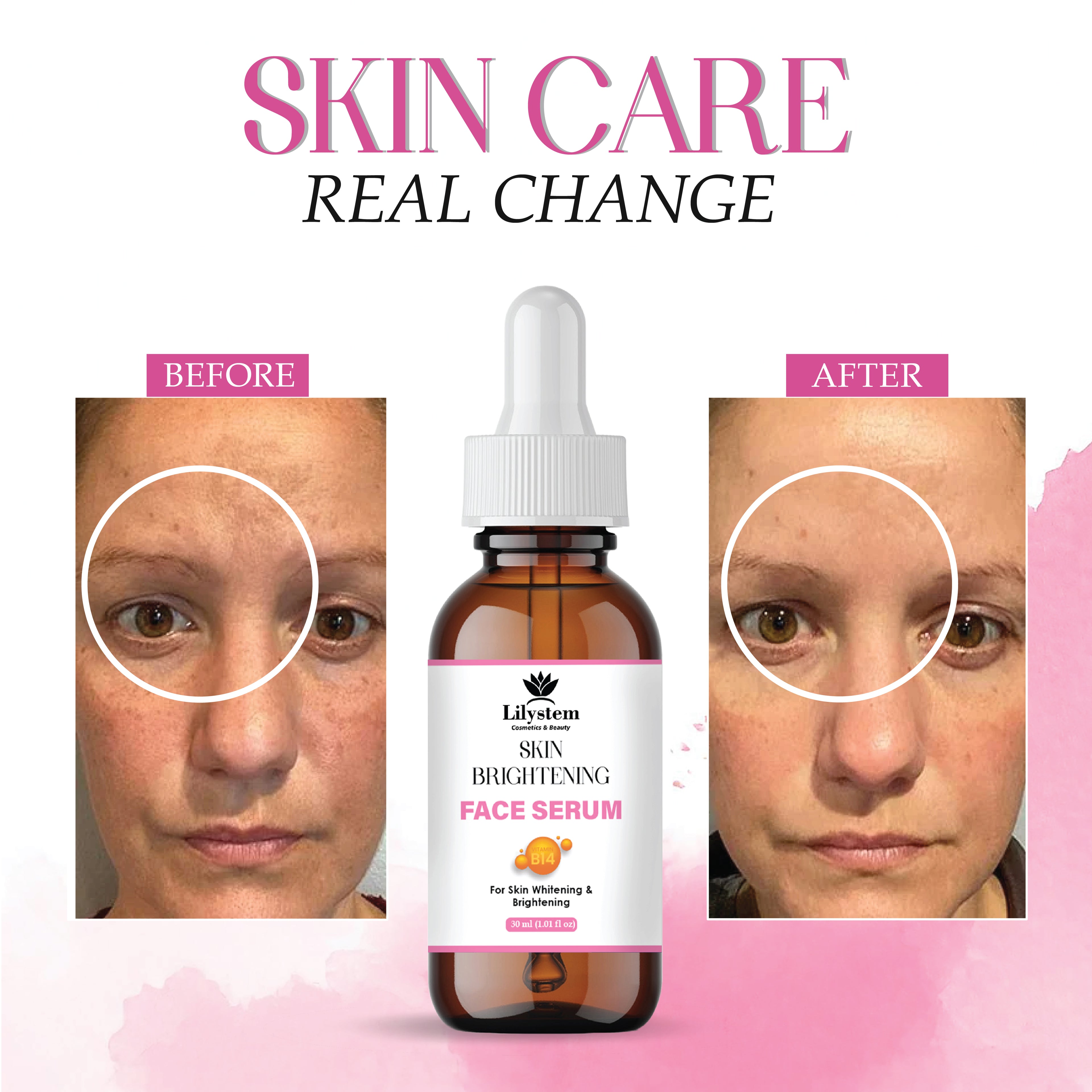 Skin Brightening Serum with Vitamin C, Hyaluronic Acid & Niacinamide – Dark Spot Corrector for Face, Hyperpigmentation Treatment, Hydrating & Anti-Aging Serum for Radiant