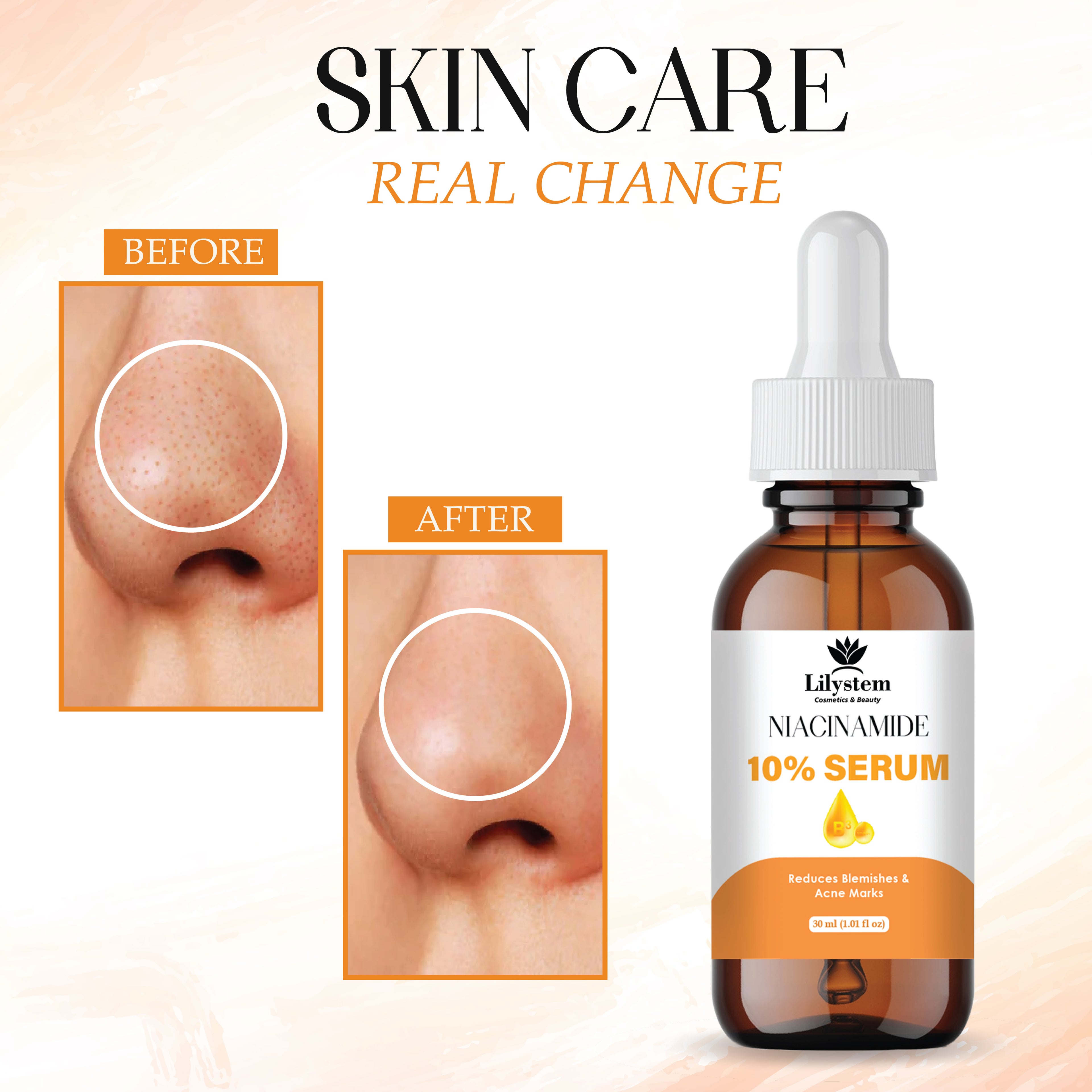 Niacinamide Serum 10% + Zinc 1% – Advanced Face Serum for Pore Minimizing, Oil Control & Brightening