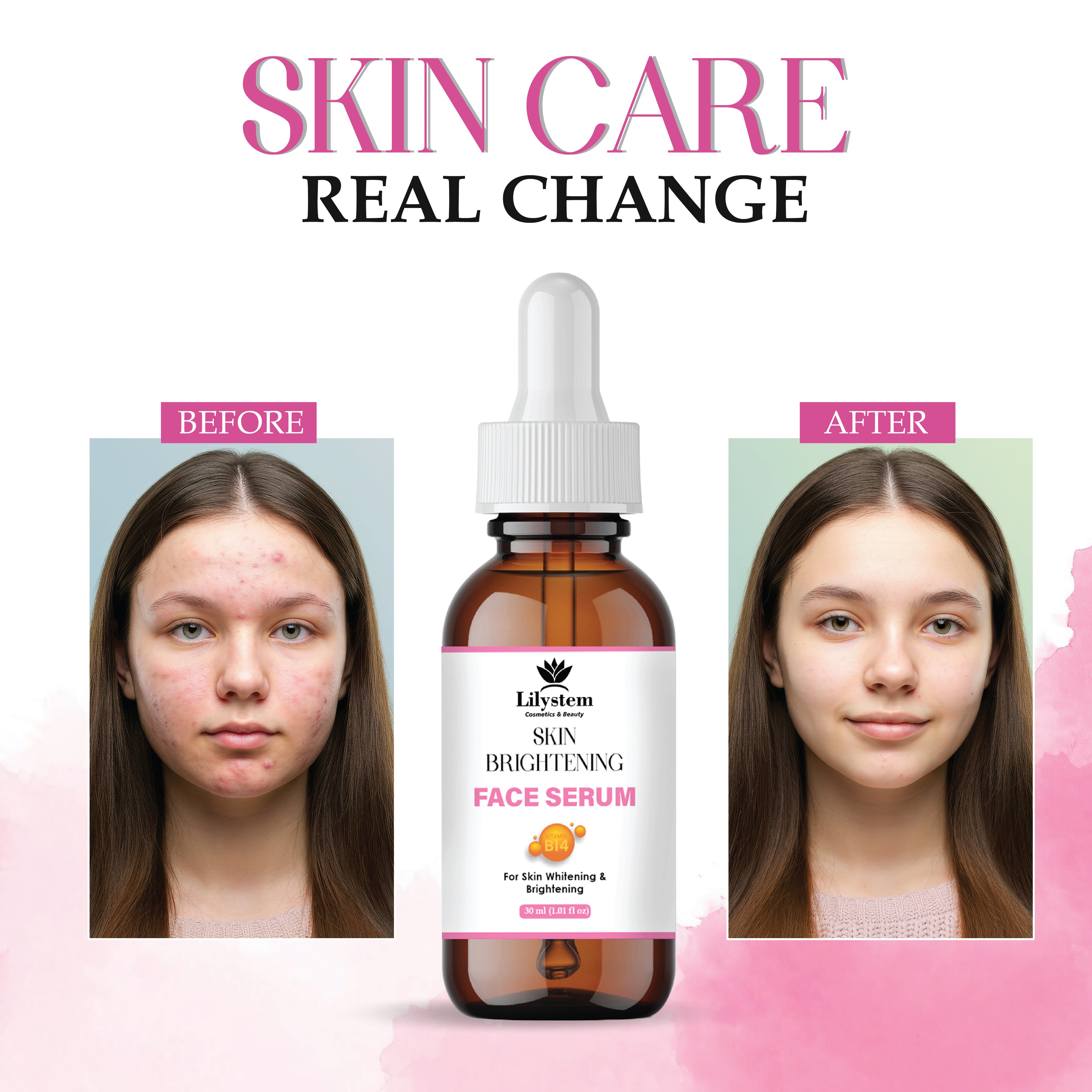Skin Brightening Serum with Vitamin C, Hyaluronic Acid & Niacinamide – Dark Spot Corrector for Face, Hyperpigmentation Treatment, Hydrating & Anti-Aging Serum for Radiant