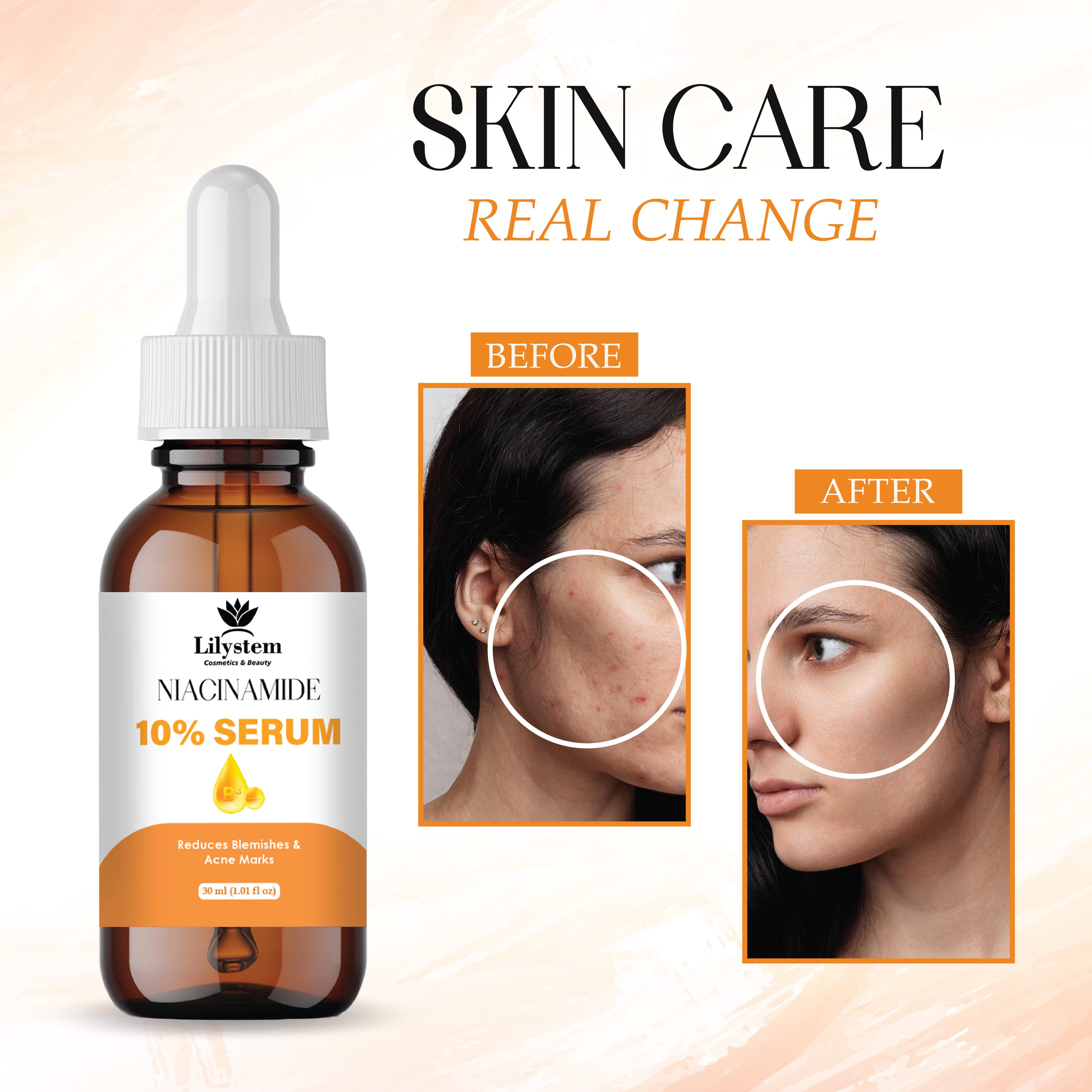 Niacinamide Serum 10% + Zinc 1% – Advanced Face Serum for Pore Minimizing, Oil Control & Brightening
