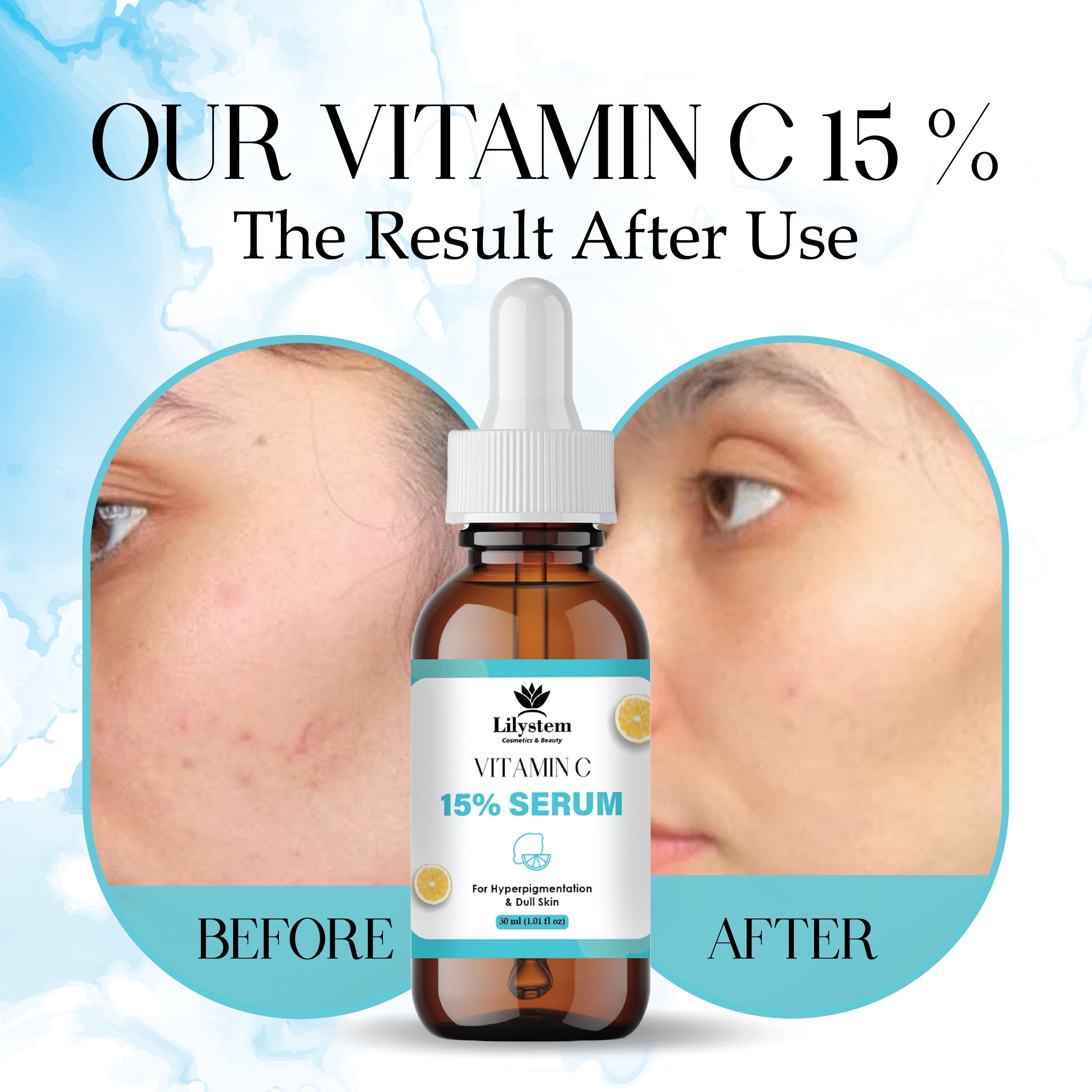 Vitamin C Serum for Face – Anti-Aging, Brightening & Hydrating Serum with Hyaluronic Acid & Vitamin E